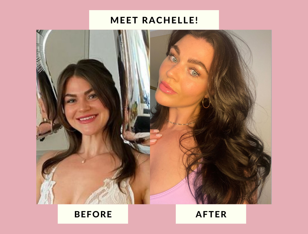 How Rachelle Reversed Her Hair Loss!