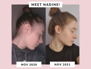 How Nadine Went From Hair Loss To Hair Goals!
