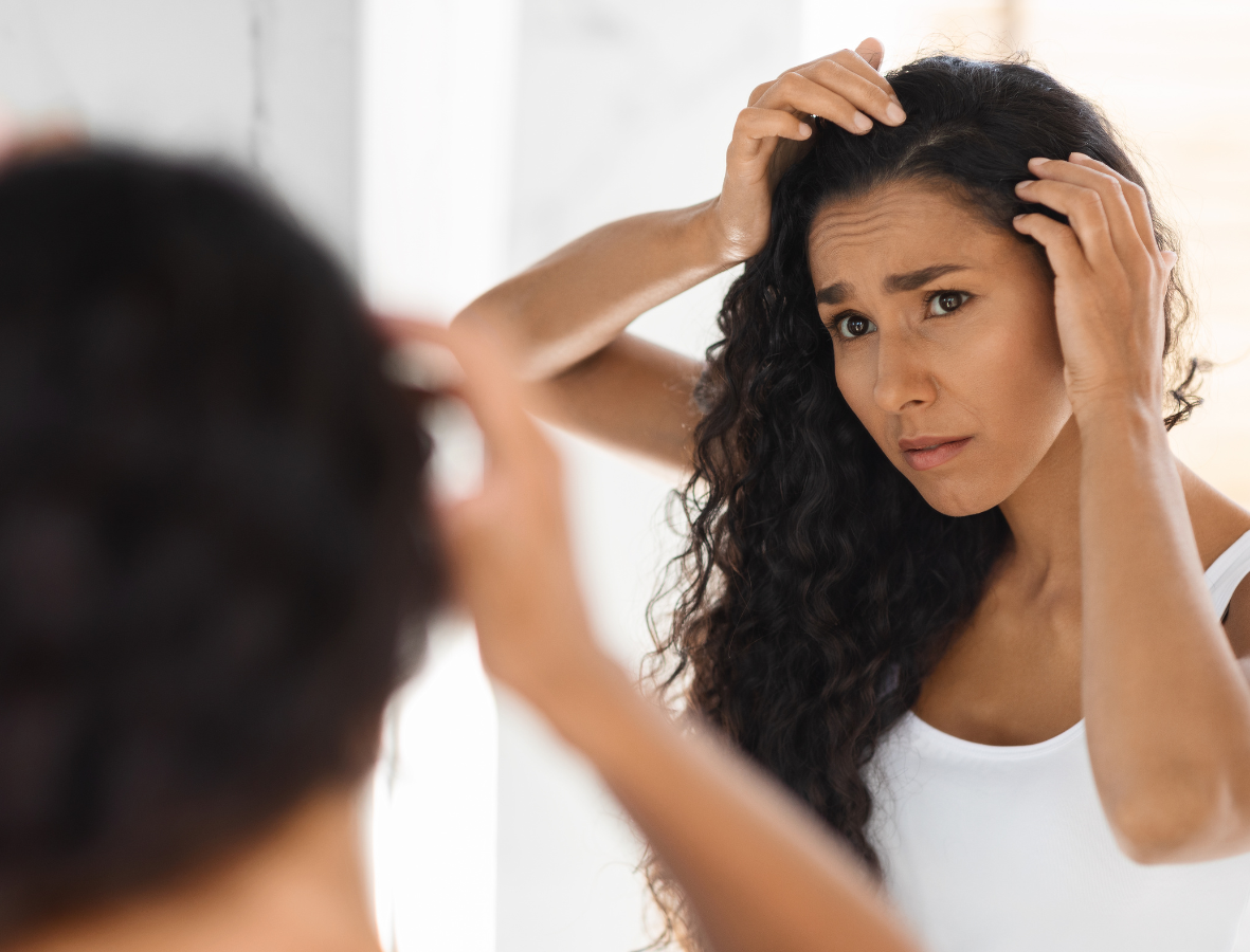 How to Deal With Dandruff: Natural Solutions for a Healthy Scalp